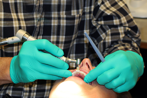 Adult Braces Adult Braces