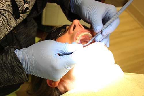 Adult Braces Adult Braces