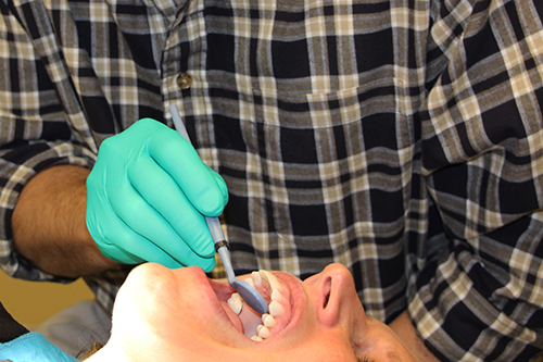 Adult Braces Adult Braces
