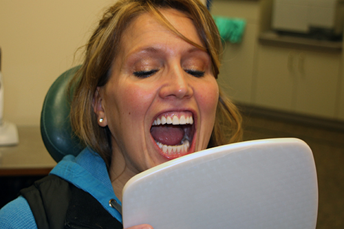 Adult Braces Adult Braces