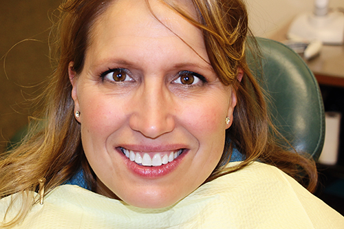 Adult Braces Adult Braces