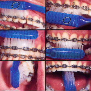 brushing upper brushing upper