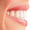 Invisalign Technology Invisalign Technology